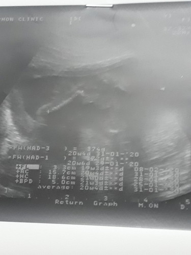 ผู้ชายหรือผู้หญิงค่ะแม่ๆๆช่วยดูให้หน่อยค่ะ