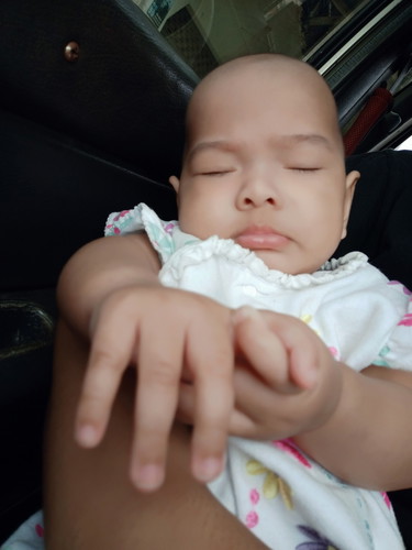 ผมลูกบาง