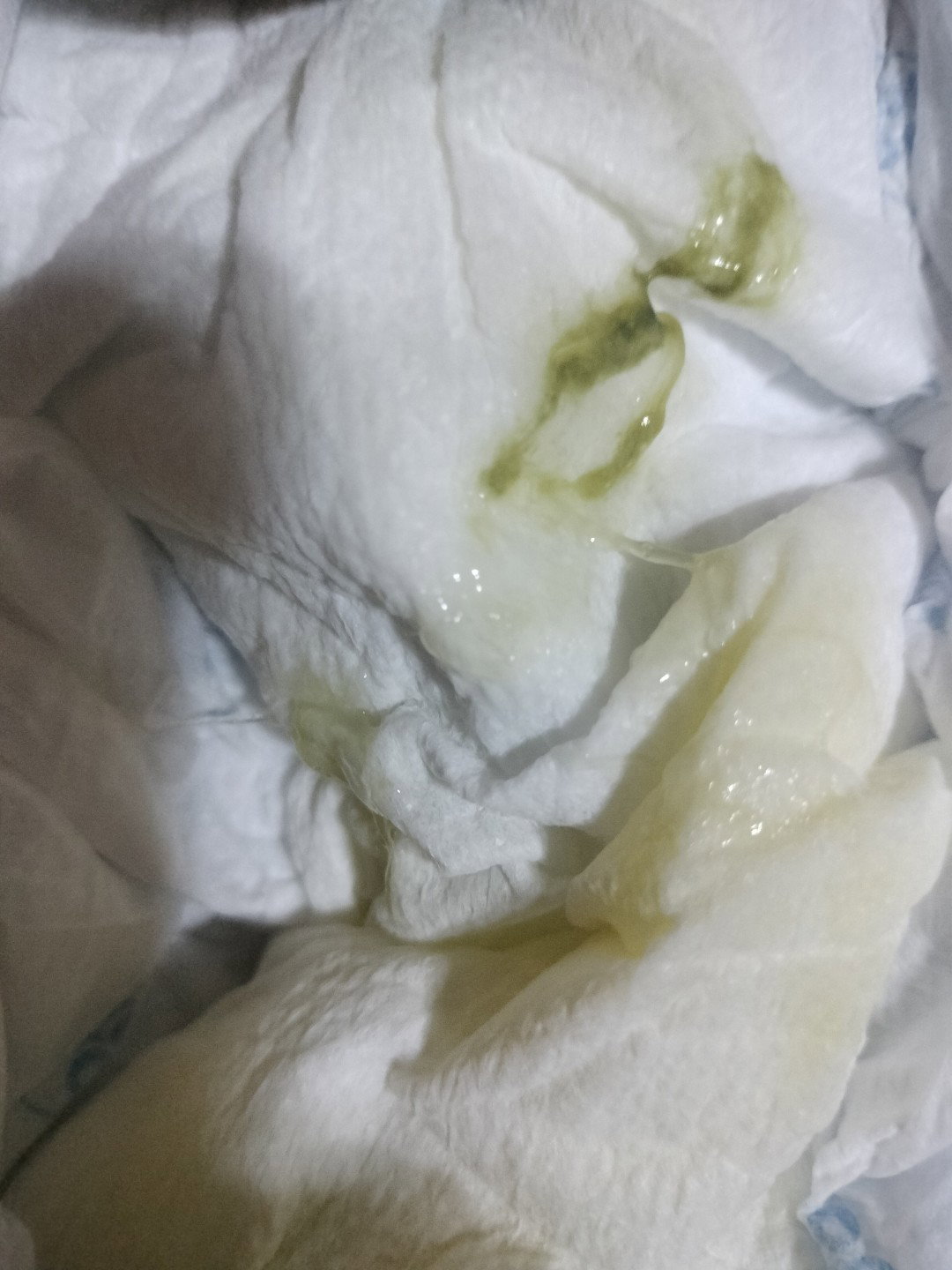 1WEEK BAGO MAG POOP SI BABY