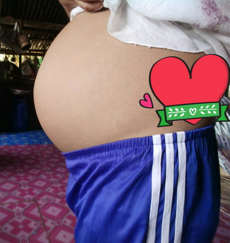 ท้องต่ำ