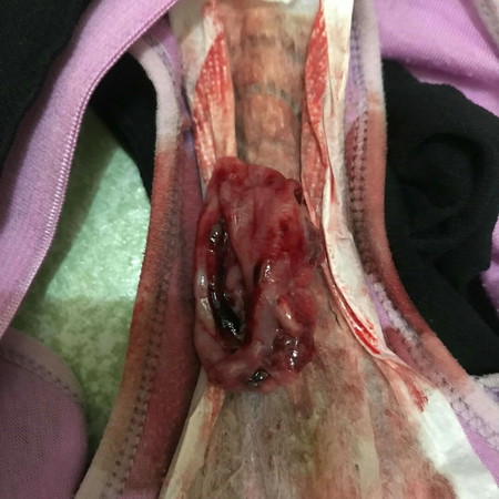 Ano po ba dapat kong gawin? Nakunan po ba ako?