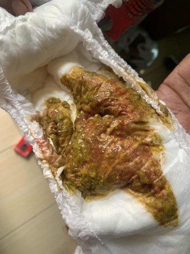 Lendir darah apa bukan