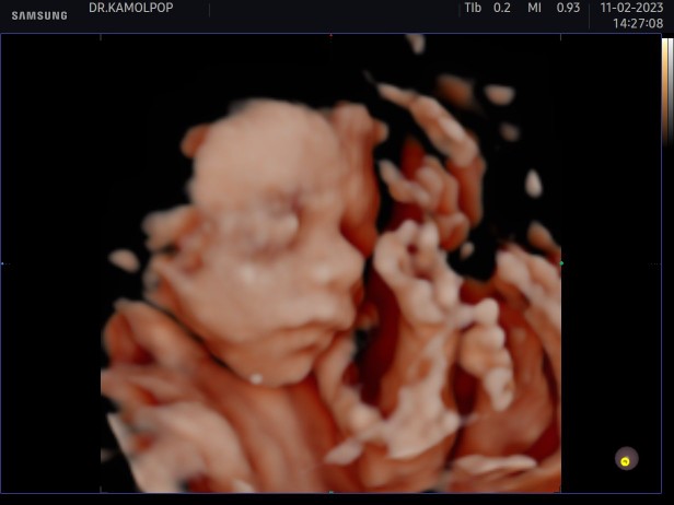 พชรเดช กำเนิดไทย profile icon