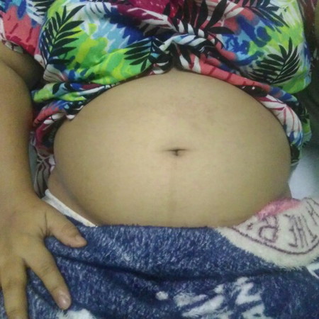 baby bump