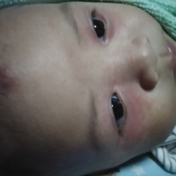 น้องๆๆเคยเป็นกันไหมค่ะ