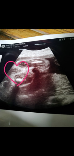 กังวลเพศลูก