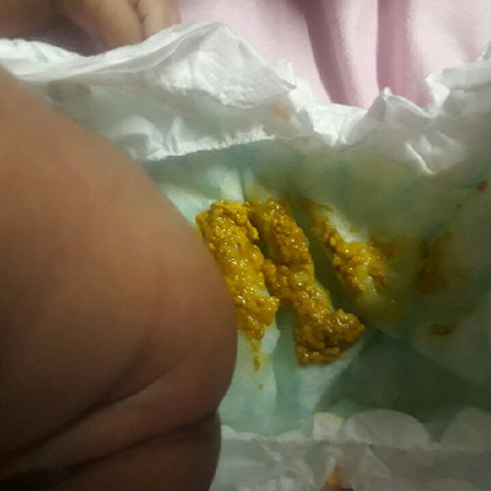 poops