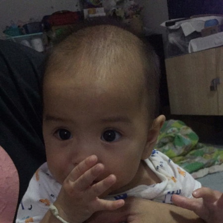 ฟันจะขึ้น