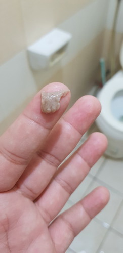 เจ็บท้อง