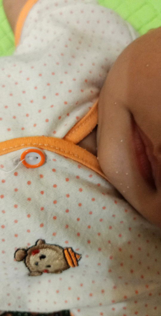 bintik putih dibawah mulut bayi