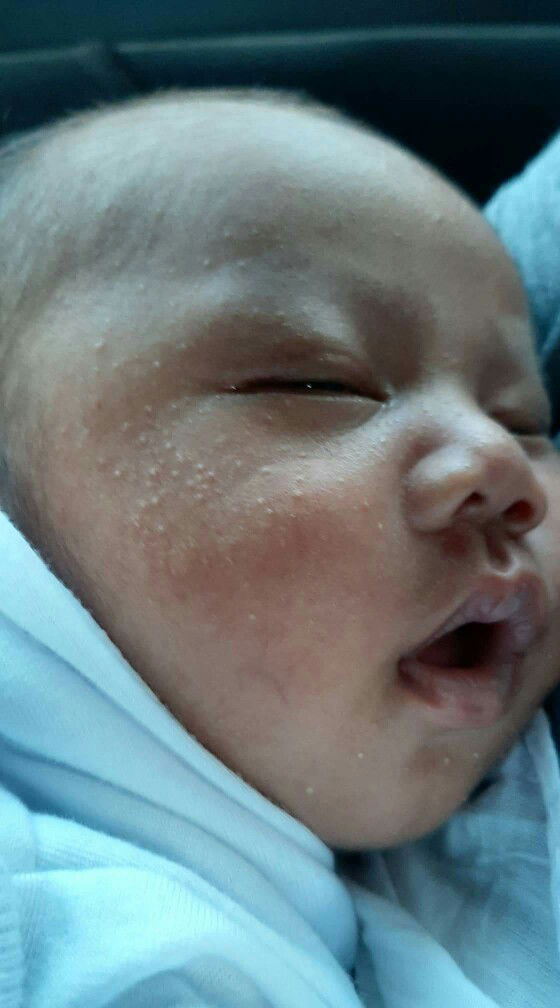 Normal lng or Need Gamotin?