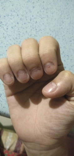 finger nails.