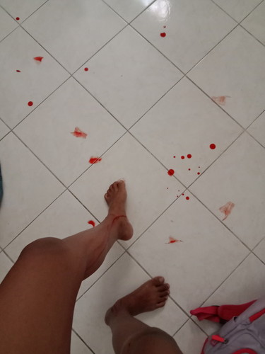 ก้อนเลือดด