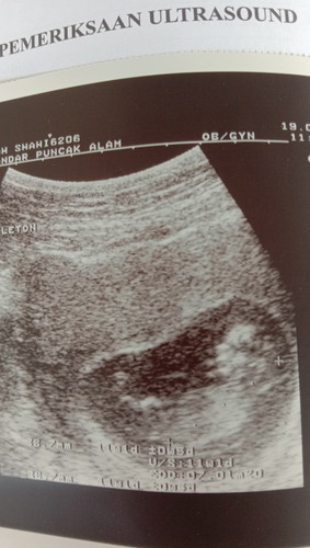 baby pic