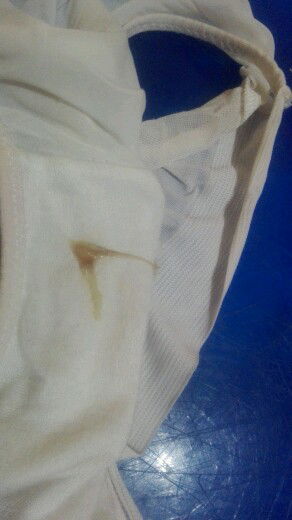 yellow with brown discharge