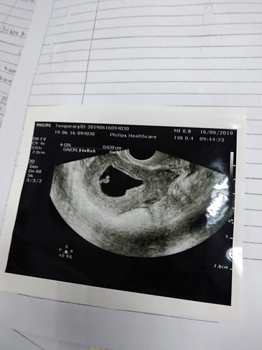 scan pagi tadi kandungan 7week