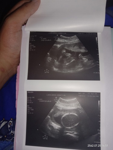 16w