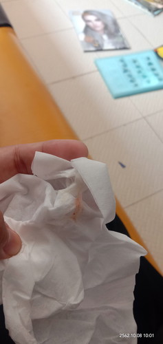 มีเลือดไหลออกมา