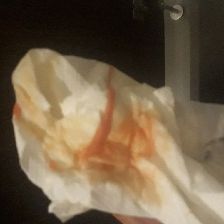 Thick White Reddish Discharge