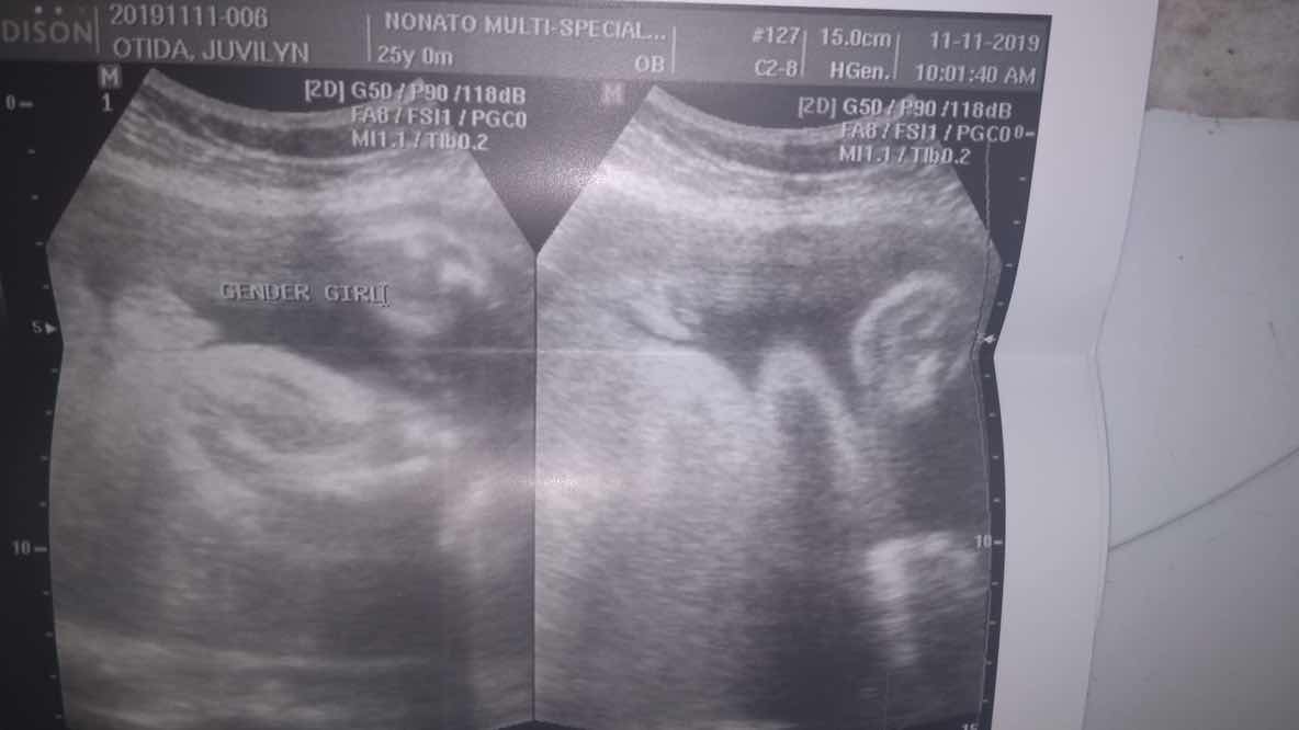 Need help so read utz