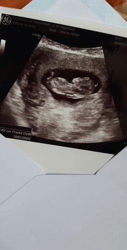 หนูได้11w6Dเเล้วจร้า