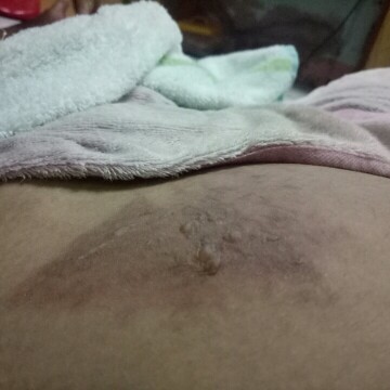 เตือนคุนเเม่