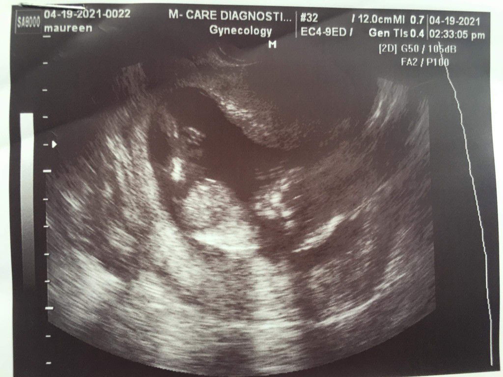 Maureen M Tuquib profile icon