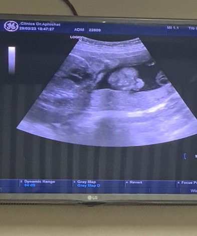 หมาต๋อง กับยอดหญ้า profile icon