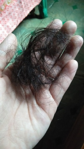 rambut rontok