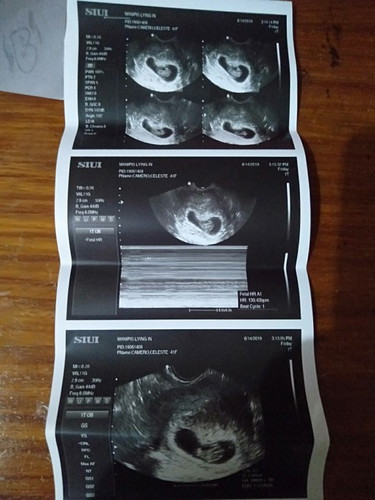 right side or left side?