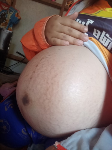 36สัปดาห์แล้วจ้า