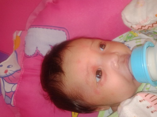 17วัน  ผื่นขึ้น