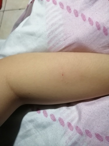 Kagat Ng Pusa