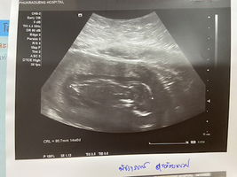 Patcharaporn Sukwatthanarom profile icon