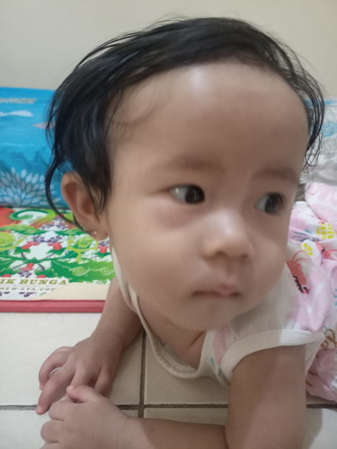 Kantung mata bengkak