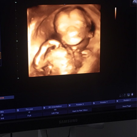 ควรทำยังไงดีค่ะ