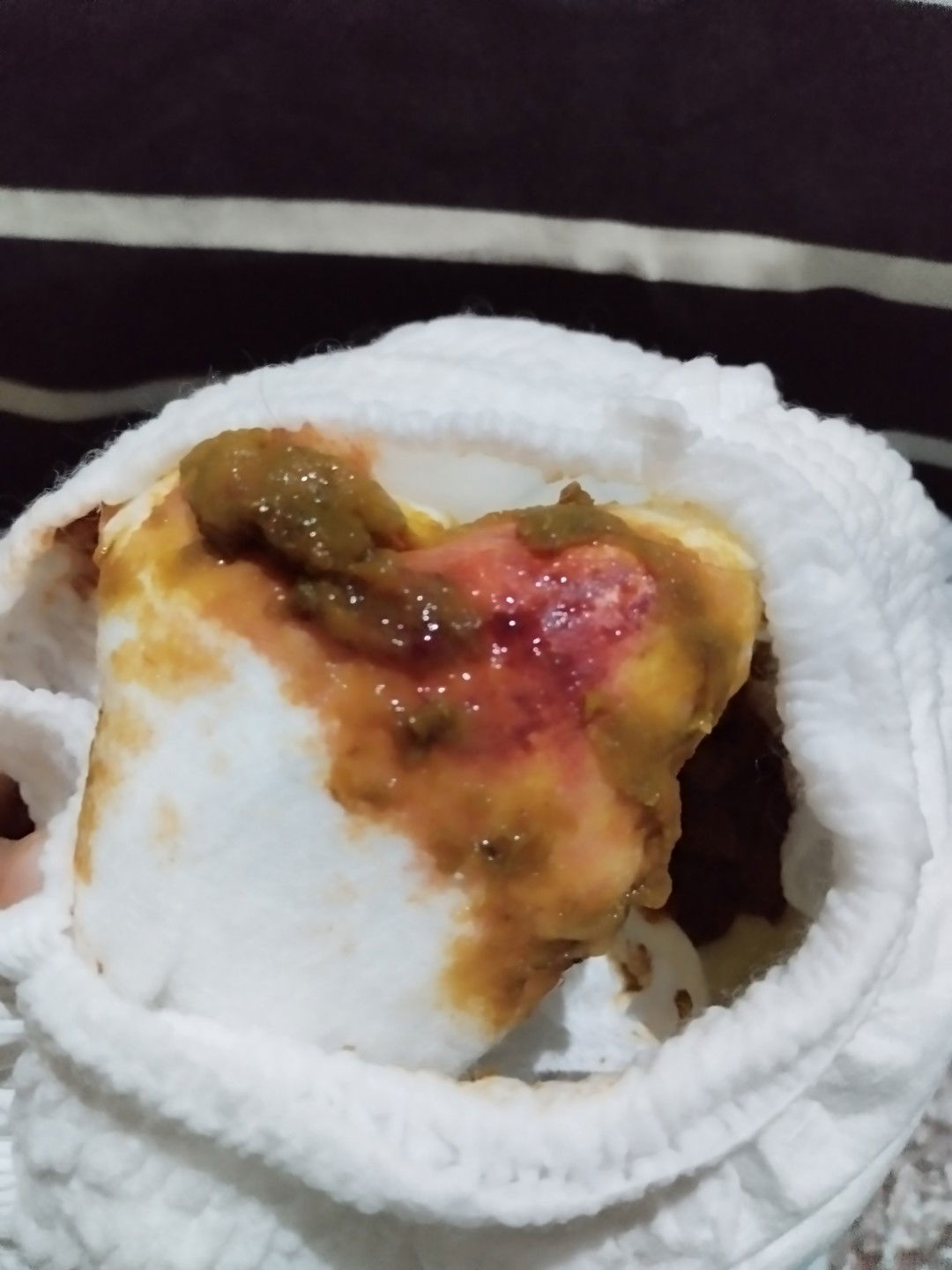 Sharing Bund Tentang PUP bayi