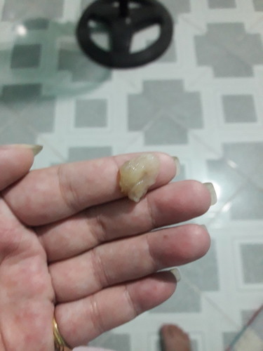 36w1d ra dich nay la bi sao ak