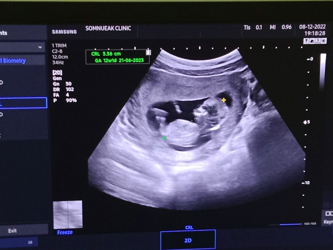 สุชิรา ชัยยะ profile icon