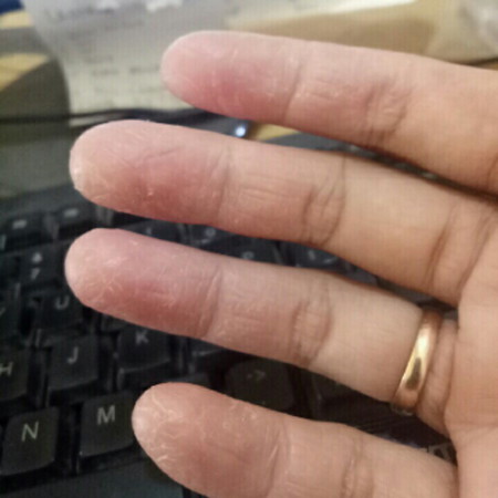tangan sensitive