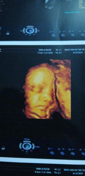 Mẹ KIẾN profile icon