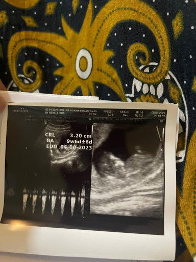 Masya Allah tabarakallah