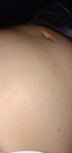 5months