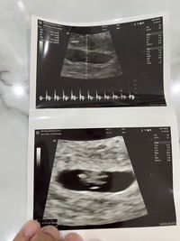 Suriyakant Kruawong profile icon