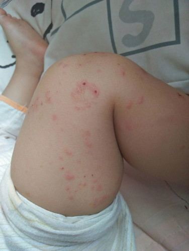 ลูกสาวแพ้อะไรไม่รู้