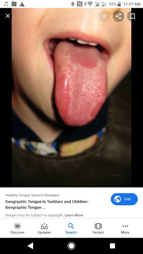 Tongue