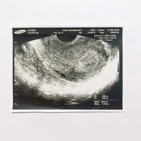 Pengalaman selama hamil