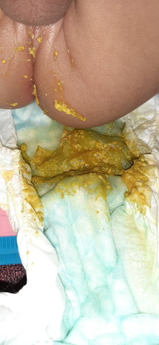 poop