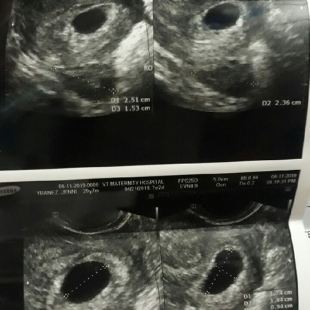 6weeks and 2days pero wala pa nkita sa transv ko