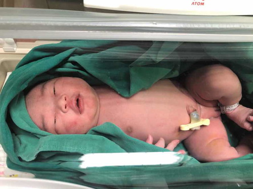 คลอดแล้วค่ะ37week 09/11/62น้ำหนัก3,150กรัม